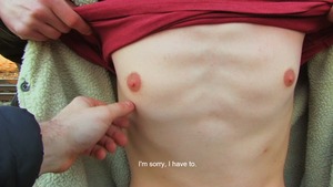 Skinny Czech twink shows his freshly gaped anus